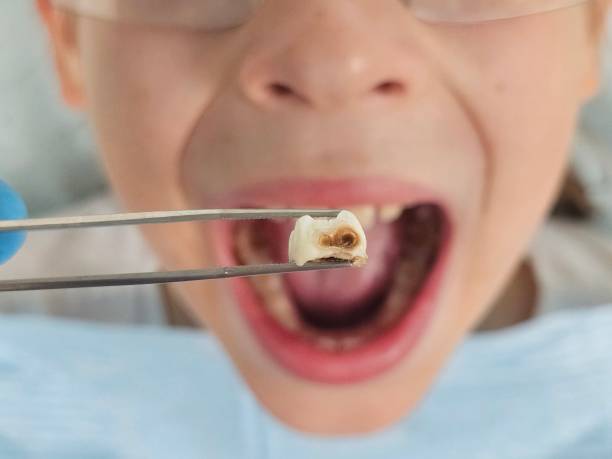Best Emergency Broken Tooth Repair in Endwell, NY